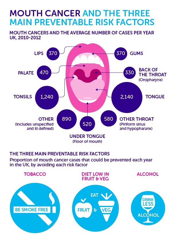 Oral Cancer Check Ups From Vitality Dental Sussex 2931