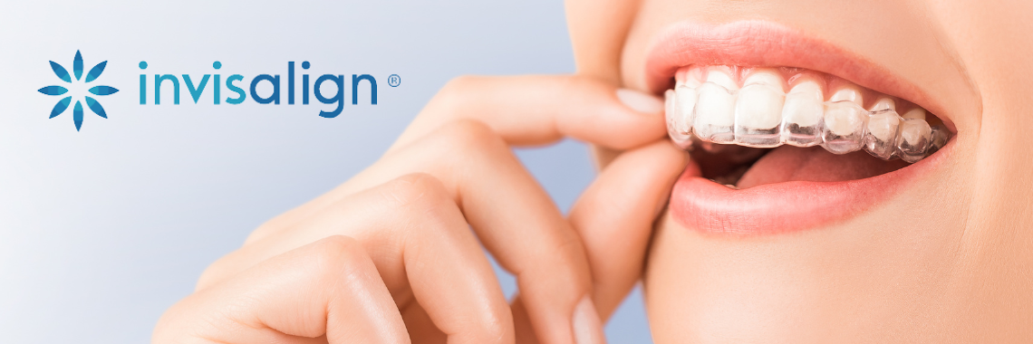 Invisalign - Moves so much more than just teeth. - OrthoDental Abbeyleix